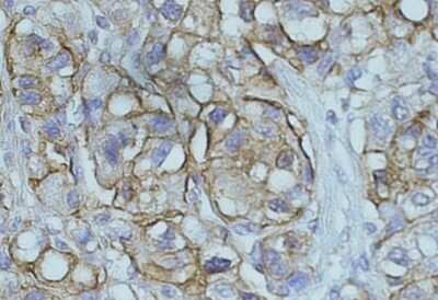 Immunohistochemistry-Paraffin: NDRG1 Antibody [NB300-839]