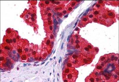 Immunohistochemistry-Paraffin: NDRG1 Antibody [NB300-839]