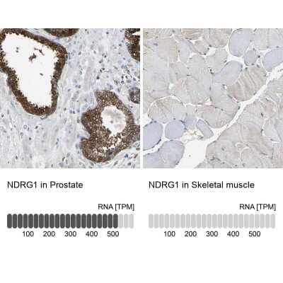 Immunohistochemistry-Paraffin: NDRG1 Antibody [NBP1-86636]