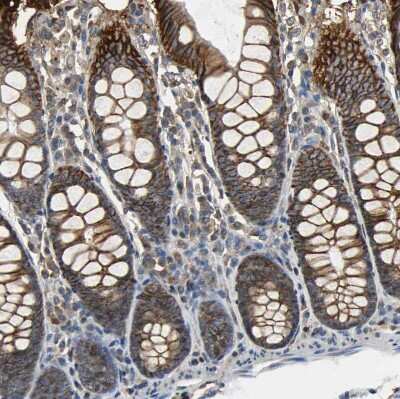 Immunohistochemistry-Paraffin: NDRG1 Antibody [NBP1-86636]