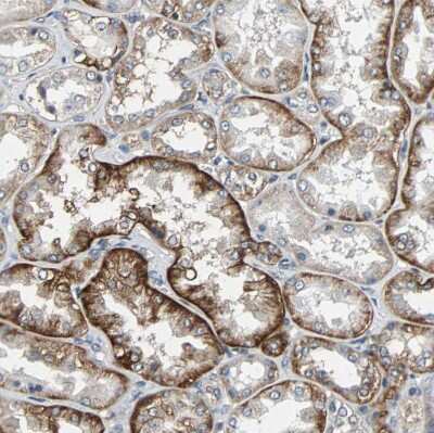 Immunohistochemistry-Paraffin: NDRG1 Antibody [NBP1-86636]