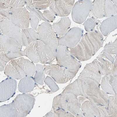 Immunohistochemistry-Paraffin: NDRG1 Antibody [NBP1-86636]