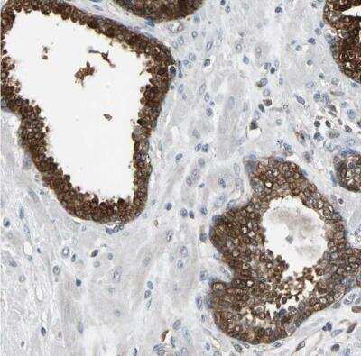 Immunohistochemistry-Paraffin: NDRG1 Antibody [NBP1-86636]