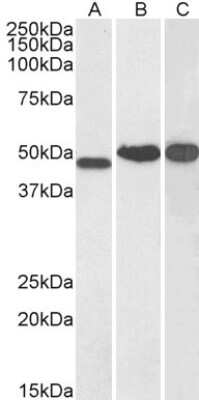 Western Blot: NDRG1 Antibody [NB300-839]