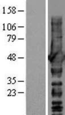 Western Blot: NDRG1 Overexpression Lysate [NBL1-13529]