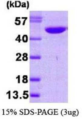 SDS-PAGE: Recombinant Human NDRG1 His Protein [NBP1-30231]