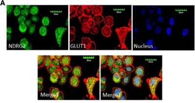 Immunocytochemistry/ Immunofluorescence: NDRG2 Antibody (6A5) [H00057447-M03]