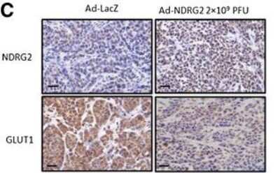 Immunocytochemistry/ Immunofluorescence: NDRG2 Antibody (6A5) [H00057447-M03]