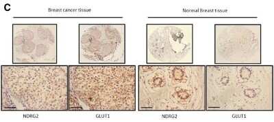 Immunohistochemistry: NDRG2 Antibody (6A5) [H00057447-M03]