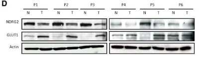 Western Blot: NDRG2 Antibody (6A5) [H00057447-M03]
