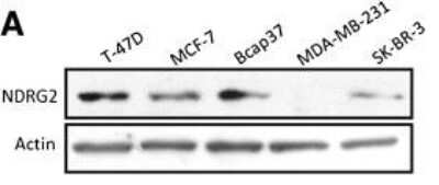 Western Blot: NDRG2 Antibody (6A5) [H00057447-M03]
