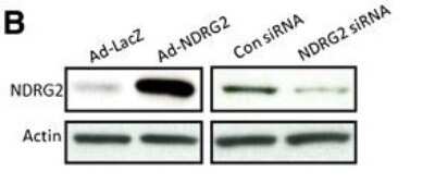 Western Blot: NDRG2 Antibody (6A5) [H00057447-M03]
