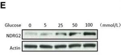 Western Blot: NDRG2 Antibody (6A5) [H00057447-M03]