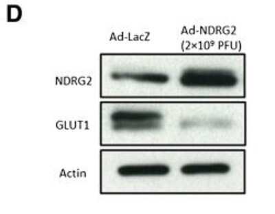 Western Blot: NDRG2 Antibody (6A5) [H00057447-M03]