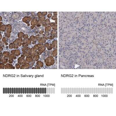 Immunohistochemistry-Paraffin: NDRG2 Antibody [NBP1-81424]