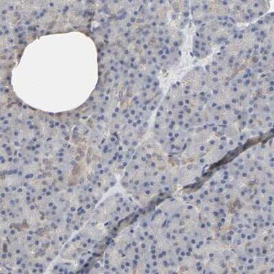 Immunohistochemistry-Paraffin: NDRG2 Antibody [NBP1-81425]