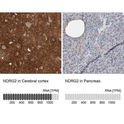Immunohistochemistry-Paraffin: NDRG2 Antibody [NBP1-81425]