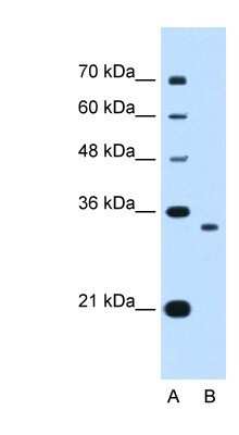 Western Blot: NDRG2 Antibody [NBP1-55431]