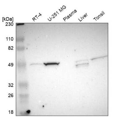 Western Blot: NDRG2 Antibody [NBP1-81425]