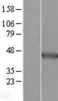 Western Blot: NDRG2 Overexpression Lysate [NBL1-13531]