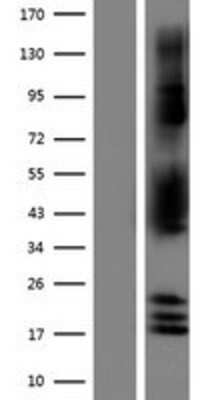 Western Blot: NDRG2 Overexpression Lysate [NBP2-10106]