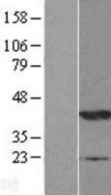 Western Blot: NDRG2 Overexpression Lysate [NBP2-10107]