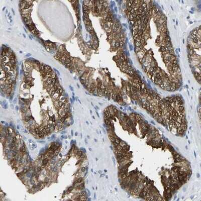 Immunohistochemistry-Paraffin: NDRG3 Antibody [NBP1-86046]
