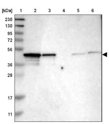 Western Blot: NDRG3 Antibody [NBP1-86046]