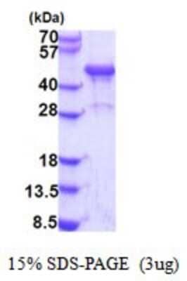 SDS-PAGE: Recombinant Human NDRG3 His Protein [NBP2-51852]