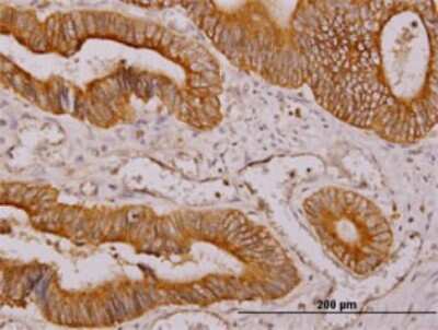 Immunohistochemistry-Paraffin: NDRG4 Antibody (2G3) [H00065009-M01]
