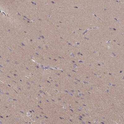 Immunohistochemistry-Paraffin: NDRG4 Antibody [NBP1-81434]