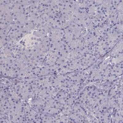 Immunohistochemistry-Paraffin: NDRG4 Antibody [NBP1-81434]