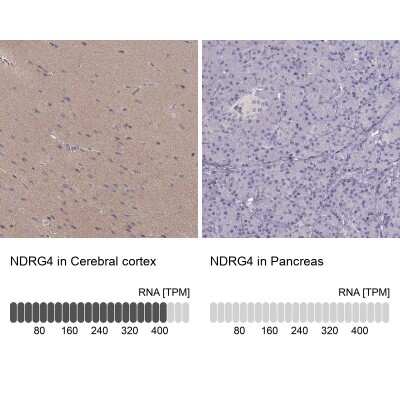 Immunohistochemistry-Paraffin: NDRG4 Antibody [NBP1-81434]