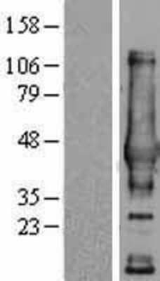 Western Blot: NDRG4 Overexpression Lysate [NBL1-13532]