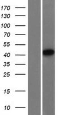 Western Blot: NDRG4 Overexpression Lysate [NBP2-09514]