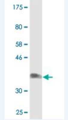 Western Blot: NDST3 Antibody (3A9) [H00009348-M02]