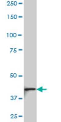 Western Blot: NDST3 Antibody (5B9) [H00009348-M01]