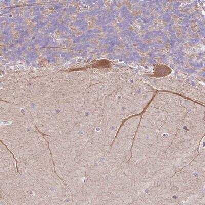 Immunohistochemistry: NDST3 Antibody [NBP2-49216]