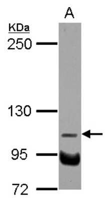 Western Blot: NDST3 Antibody [NBP2-19501]