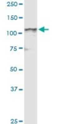 Western Blot: NDST4 Antibody [H00064579-D01P]