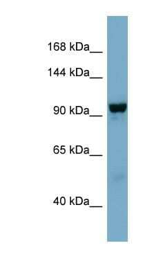 Western Blot: NDST4 Antibody [NBP1-62410]