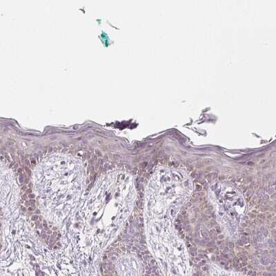 Immunohistochemistry-Paraffin: NDUFA1 Antibody [NBP2-49127]