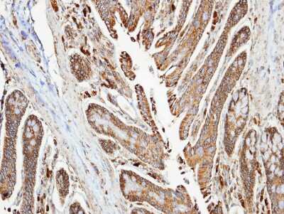 Immunohistochemistry-Paraffin: NDUFA10 Antibody [NBP1-32146]