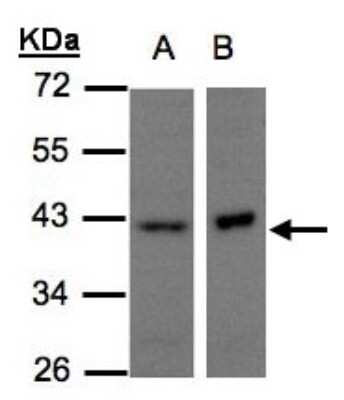 Western Blot: NDUFA10 Antibody [NBP1-32146]