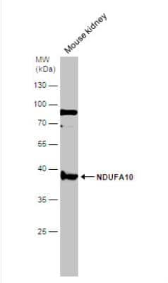 Western Blot: NDUFA10 Antibody [NBP1-32146]