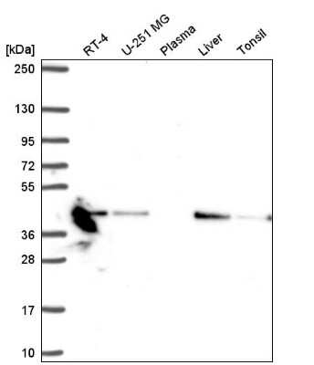 Western Blot: NDUFA10 Antibody [NBP2-57008]