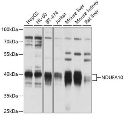 Western Blot: NDUFA10 AntibodyBSA Free [NBP2-93125]