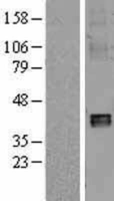 Western Blot: NDUFA10 Overexpression Lysate [NBL1-13535]