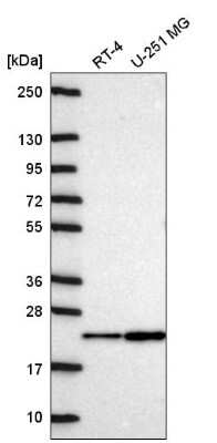 Western Blot: NDUFA11 Antibody [NBP2-58831]