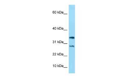 Western Blot: NDUFA11 Antibody [NBP2-83261]